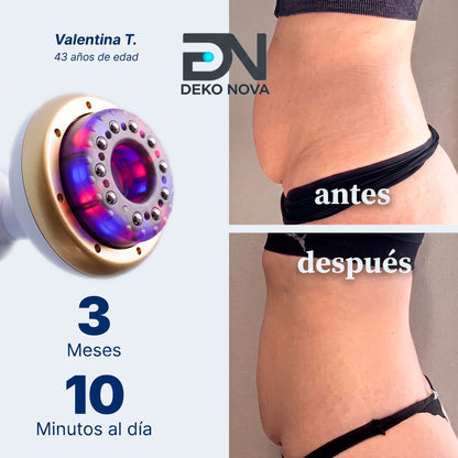 Deko Nova® Sculpt Pro™