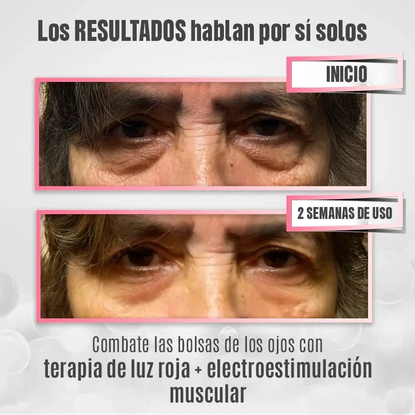 RevitalEyes® 2 en 1: Terapia de Luz Roja y EMS para Eliminar Bolsas de los Ojos