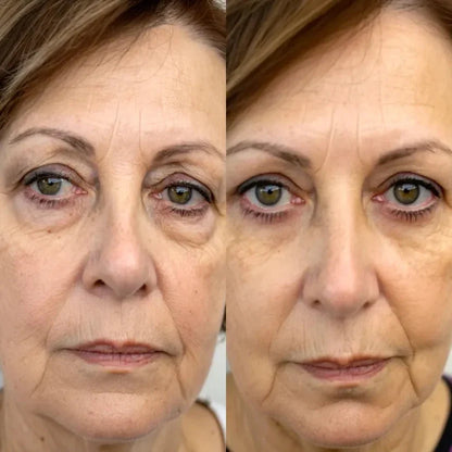 RevitalEyes® 2 en 1: Terapia de Luz Roja y EMS para Eliminar Bolsas de los Ojos