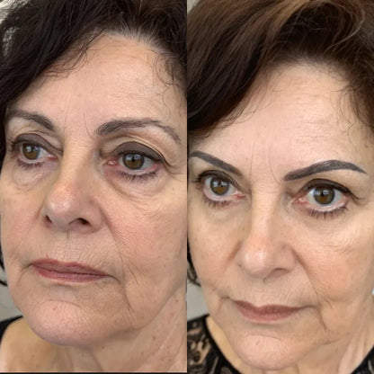 RevitalEyes® 2 en 1: Terapia de Luz Roja y EMS para Eliminar Bolsas de los Ojos